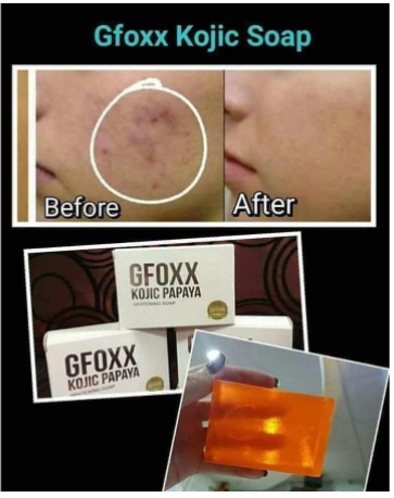 GFoxx Kojic Papaya Whitening Soap 135g