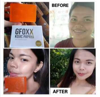 GFoxx Kojic Papaya Whitening Soap 135g